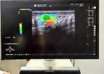 Ecograf de ultimă generație la OncoHelp, care ajută la creşterea acurateţii diagnosticului