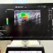 Ecograf de ultimă generație la OncoHelp, care ajută la creşterea acurateţii diagnosticului