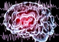 Spitalul CFR din Timişoara: „Epilepsia este una dintre cele mai frecvente afecțiuni neurologice cronice”