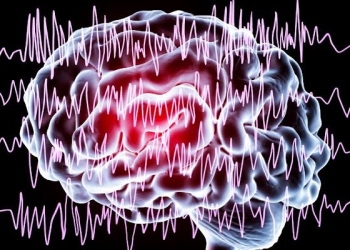 Spitalul CFR din Timişoara: „Epilepsia este una dintre cele mai frecvente afecțiuni neurologice cronice”