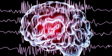 Spitalul CFR din Timişoara: „Epilepsia este una dintre cele mai frecvente afecțiuni neurologice cronice”