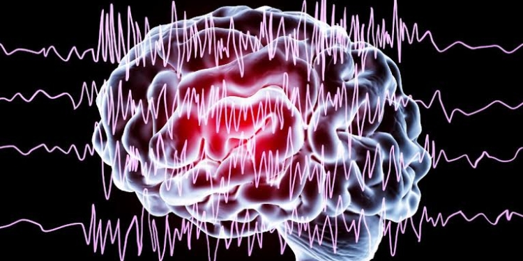 Spitalul CFR din Timişoara: „Epilepsia este una dintre cele mai frecvente afecțiuni neurologice cronice”